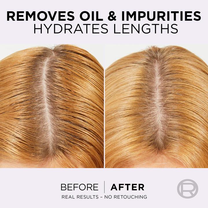 Produktbild L'Oréal Professionnel LÂ'OrÃ©al Professionnel - Elseve Hyaluron Pure 250ml (Flüssiges Shampoo, 250 ml)