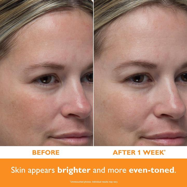 Produktbild Peter Thomas Roth Potent-C Power Serum (30 ml)