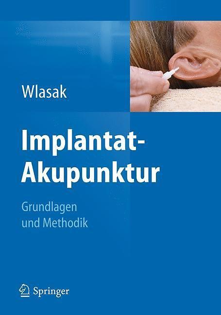 Produktbild Implantat-Akupunktur (Deutsch, 2012)