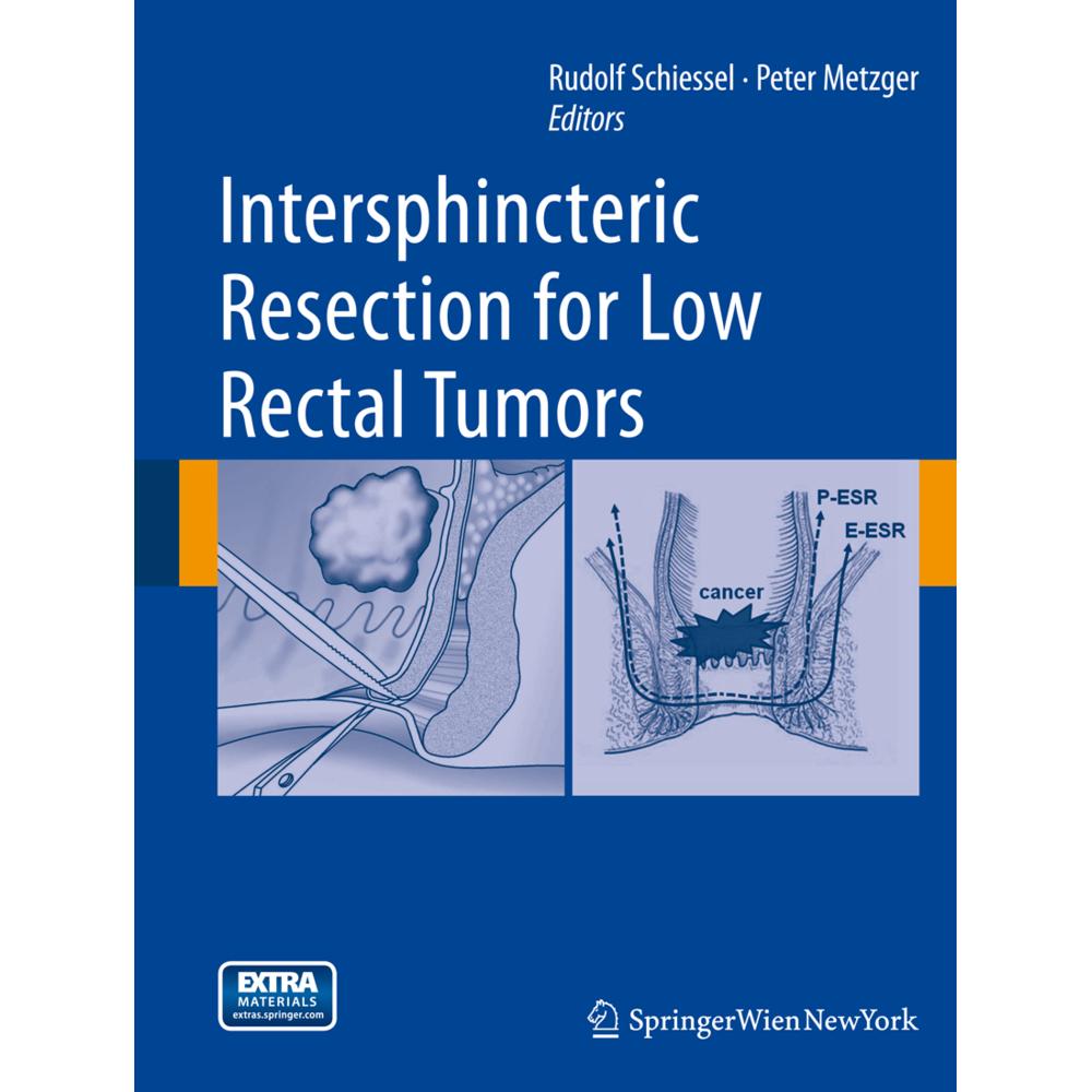 Intersphincteric Resection for Low Rectal Tumors, Fachbücher von Peter Metzger, Rudolf Schiessel