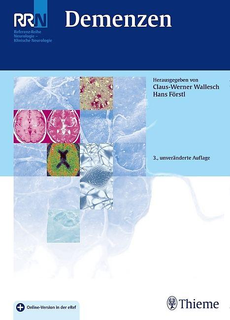 Produktbild Demenzen (Deutsch)