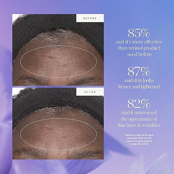 Actual product image Kora Organics Plant Stem Cell Retinol Alternative Moisturizer 1.69 fl oz Full-Size Jar (Body milk, 1.69 ml)