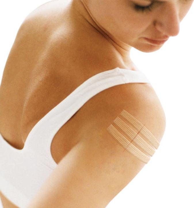 Actual product image 3M Nexcare Steri-Strips wound closure strips (8x)