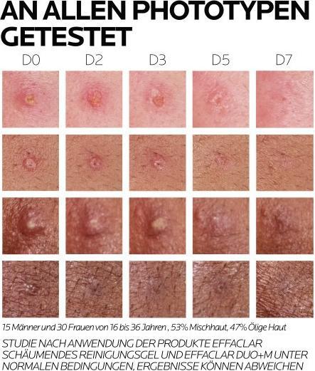 Nährwerte und Zutaten La Roche Posay Effaclar Duo+M (40 ml, 24h Creme)