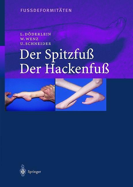 Produktbild Fussdeformitäten (Deutsch, Leonhard Döderlein, Urs Schneider, Wolfram Wenz, 2012)