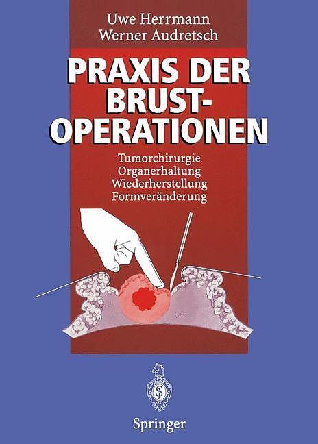 Produktbild Praxis der Brustoperationen (Deutsch, Uwe Herrmann, Werner Audretsch, 2012)