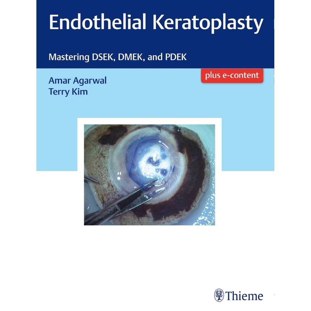 Thieme, Stuttgart, Praxisbedarf, Agarwal:Endothelial Keratoplasty
