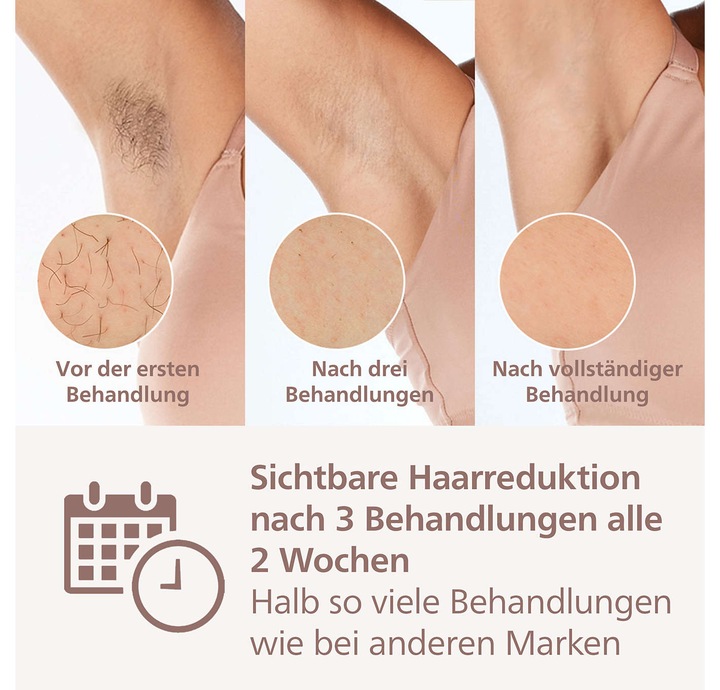 Productafbeelding Philips Lumea IPL Series 9000