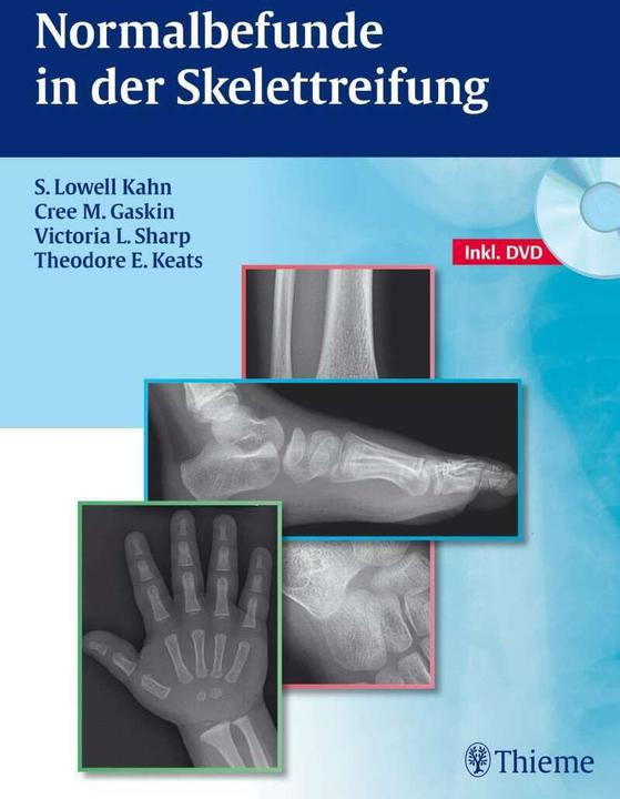 Produktbild Normalbefunde in der Skelettreifung (Deutsch, Cree M. Gaskin, S. Lowell Kahn, Theodore E. Keats, Victoria L. Sharp, 2012)