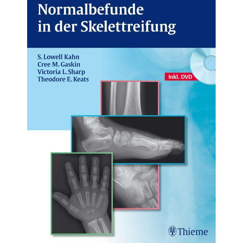 Normalbefunde in der Skelettreifung, Fachbücher von Cree M. Gaskin, S. Lowell Kahn, Theodore E. Keats, Victoria L. Sharp