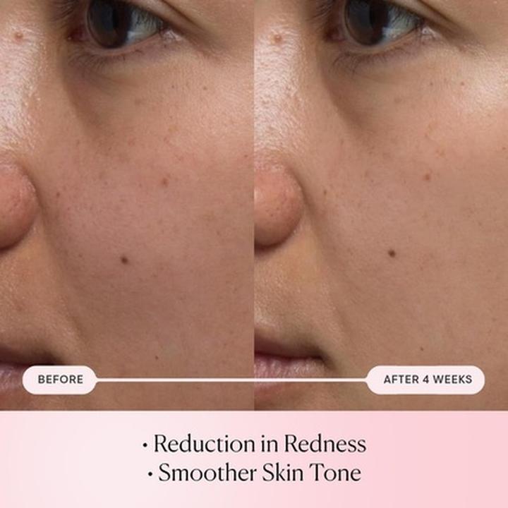 Actual product image Elemis Pro-Collagen Rose Micro Serum Hydration Serum for Plumping, Soothing, and Nourishing Skin - Reduce F (30 ml)