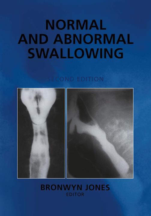 Normal and Abnormal Swallowing (2011)