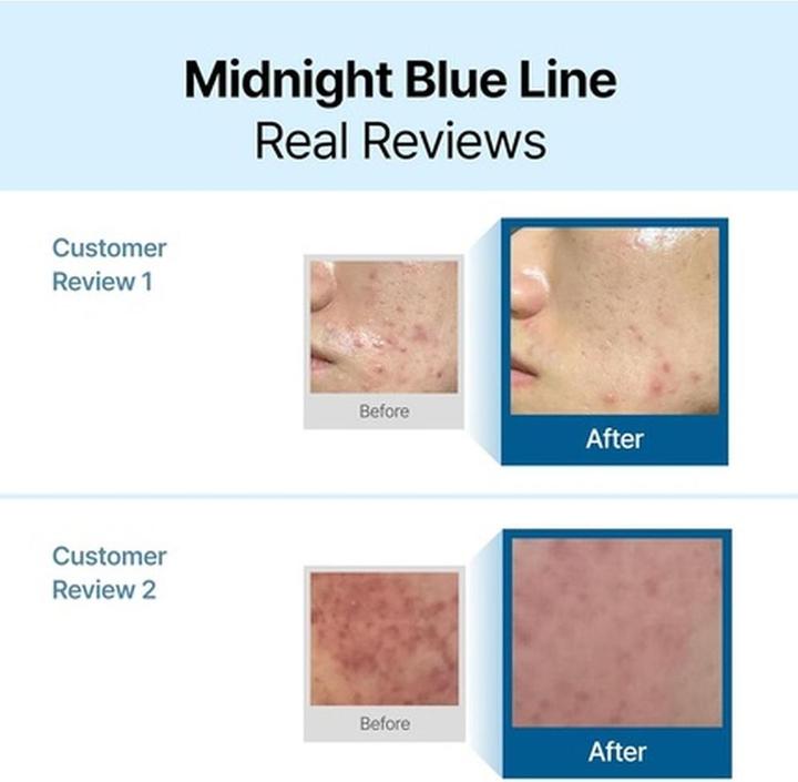 Image du produit Klairs bleu nuit (60 ml)