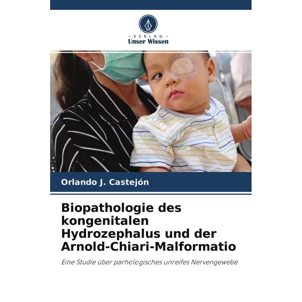 Biopathologie des kongenitalen Hydrozephalus und der Arnold-Chiari-Malformatio, Fachbücher von Orlando J. Castejón