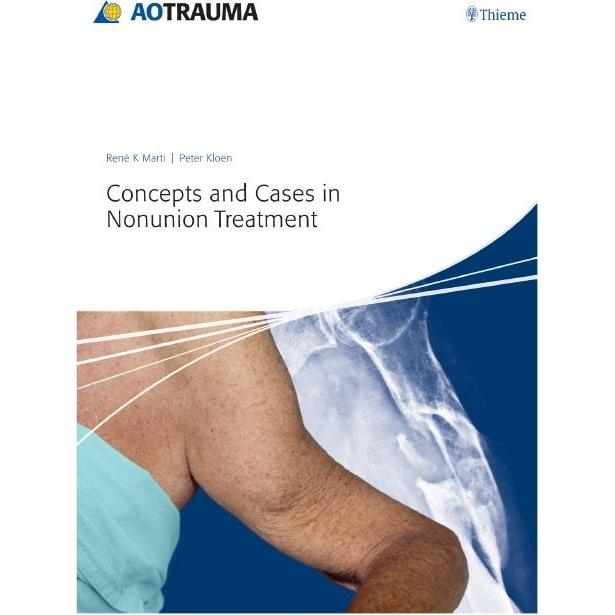 Marti:Concepts and Cases in Nonunion Tr, Sachbücher von Peter Kloen, René K. Marti