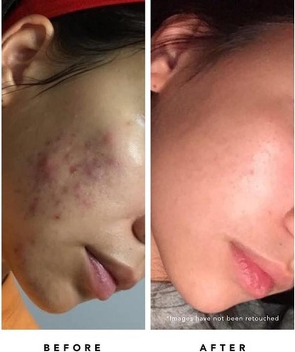 Actual product image Herbivore Botanicals Organic Blue Tansy Resurfacing Mask (60 ml)