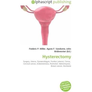 Thumbnail - Hysterectomy, Fachbücher