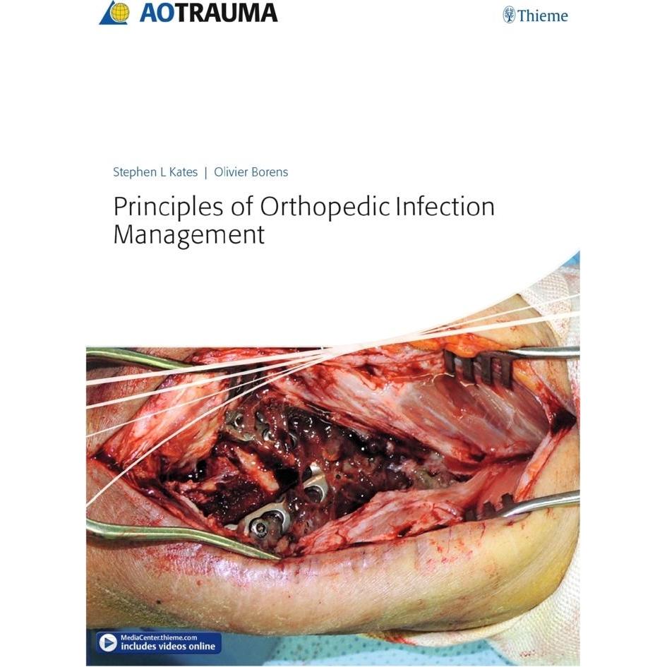 Principles of Orthopedic Infection Management, Sachbücher von Olivier Borens, Stephen Kates