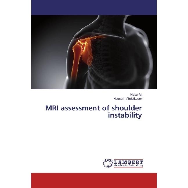 MRI assessment of shoulder instability, Fachbücher von Hossam Abdelkader, Heba Ali