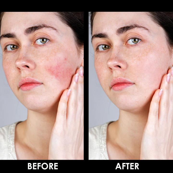 Produktbild Arval Couperoll Notfall Creme (50 ml, SPF 20)