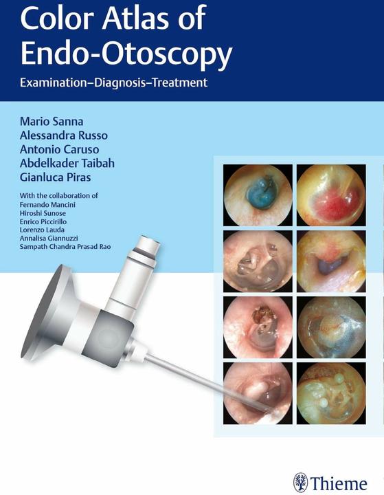 Produktbild Color Atlas of Endo-Otoscopy (Englisch, Abdelkader Taibah, Alessandra Russo, Antonio Caruso, Gianluca Piras, Mario Sanna, 2017)