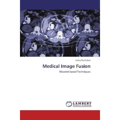 Medical Image Fusion, Fachbücher von Latha Parthiban