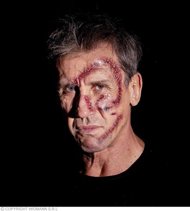 Actual product image Widmann Stitched wound
