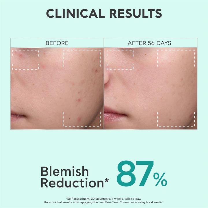 Produktbild Apivita Just Bee Clear Anti-Imperfections Mattifying Moisturizing Gel-Cream For Oily Skin - 40 Ml (40 ml)