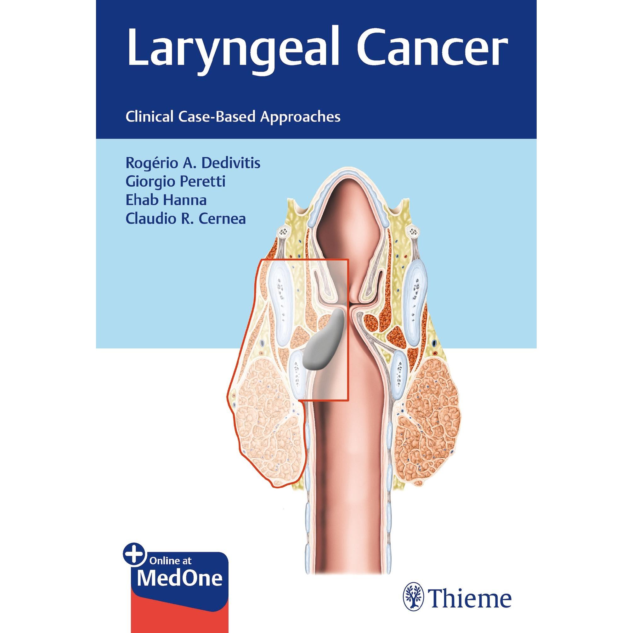 Laryngeal Cancer, Fachbücher von Rogério A. Dedivitis Giorgio Peretti Ehab Y. Hanna Claudio R. Cernea