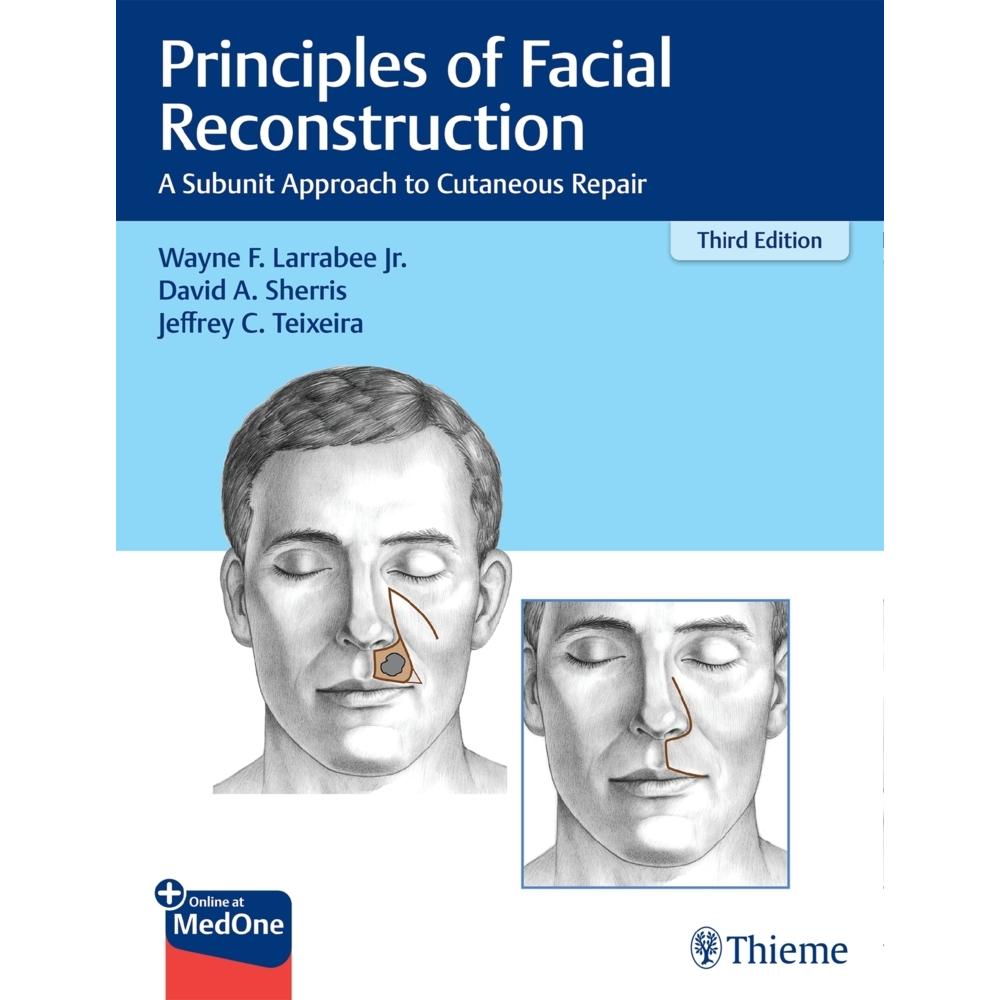 Larrabee:Principles of Facial Reconstru, Sachbücher von Jeffrey Teixeira, David A. Sherris, Wayne F. Larrabee