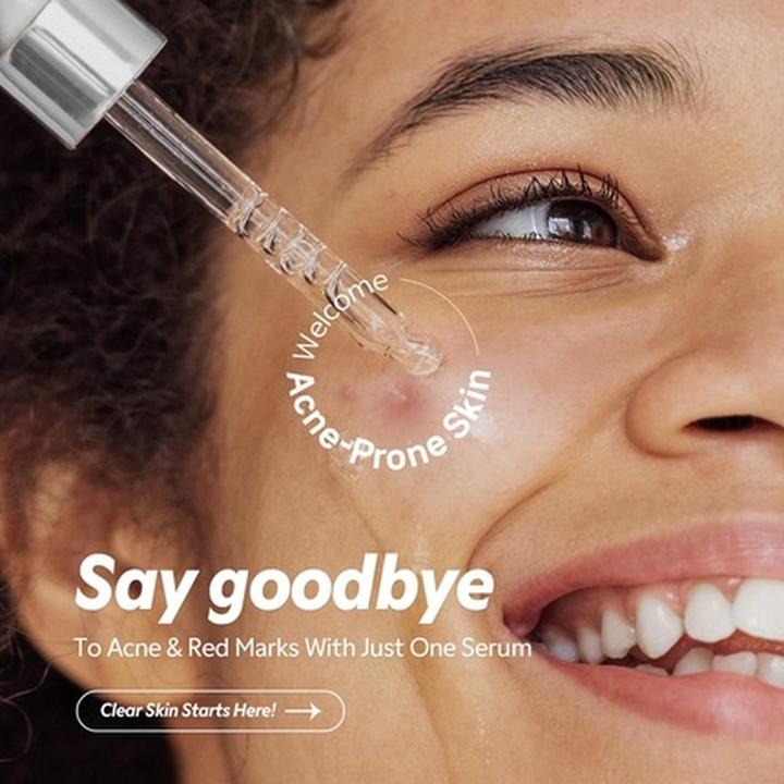 Actual product image TirTir Azelaic Acid Serum