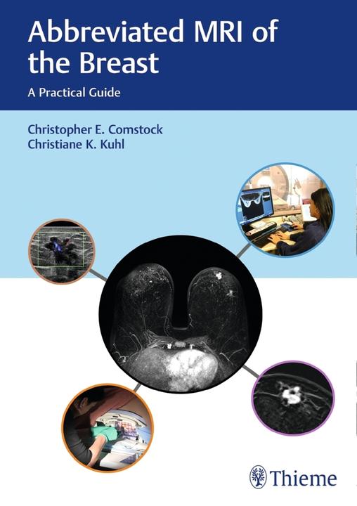 Produktbild Abbreviated MRI of the Breast (Englisch, Christiane Kuhl, Christopher E. Comstock, 2018)
