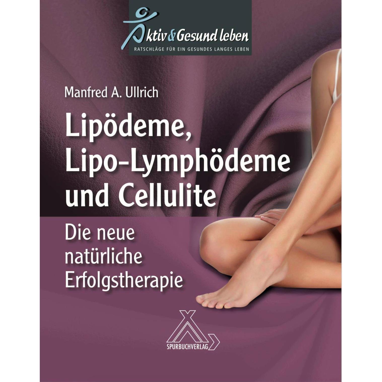 Ullrich:Lipoödeme, Lipo-Lymphödeme und, Ratgeber von Manfred A. Ullrich