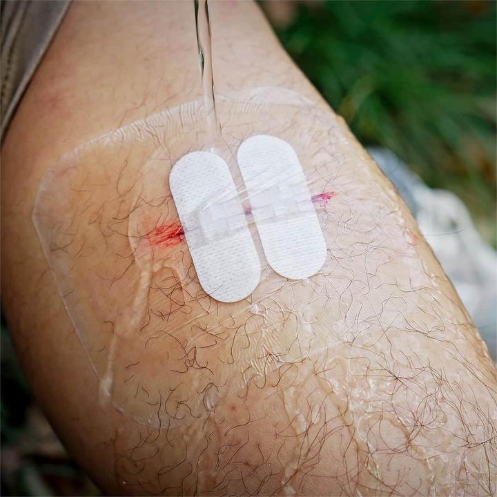 Produktbild Rhino Rescue Wound Closure Kit (10-teilig)