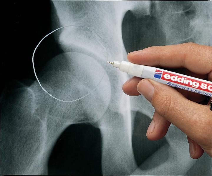 Actual product image Edding X-ray marker 8010 (White, 0.80 mm, 1 x)