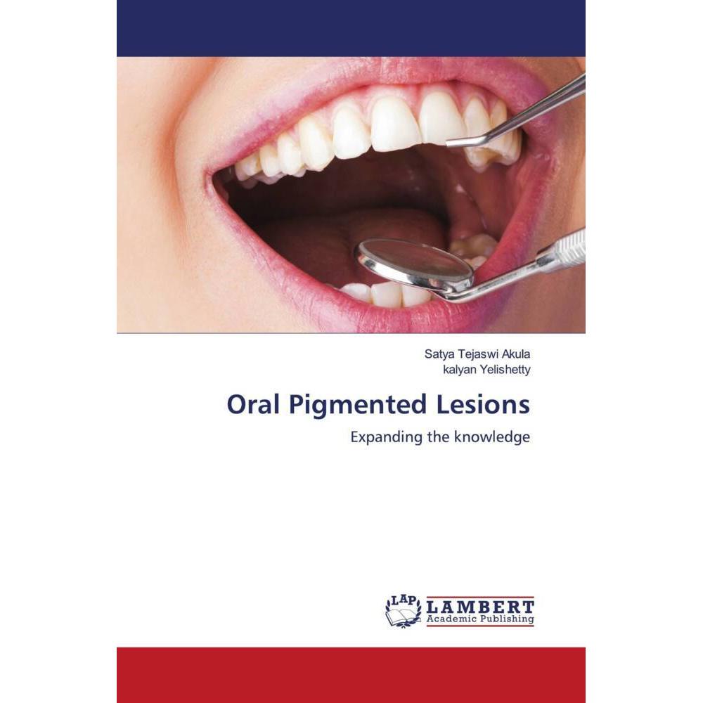 Oral Pigmented Lesions, Fachbücher von Satya Tejaswi Akula, kalyan Yelishetty