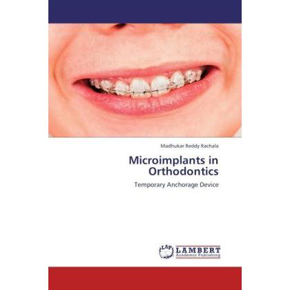 Microimplants in Orthodontics, Fachbücher von Madhukar Reddy Rachala