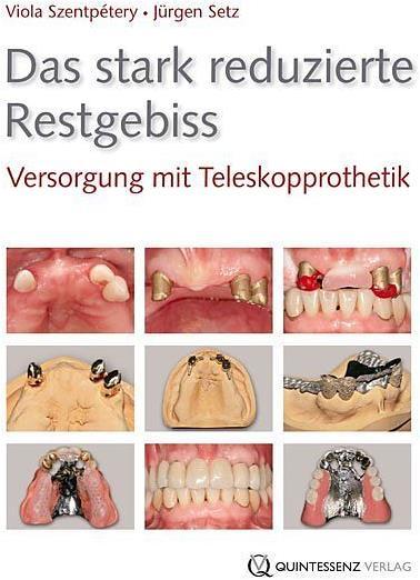 Produktbild Das stark reduzierte Restgebiss (Deutsch, Viola Szentpétery, 2015)