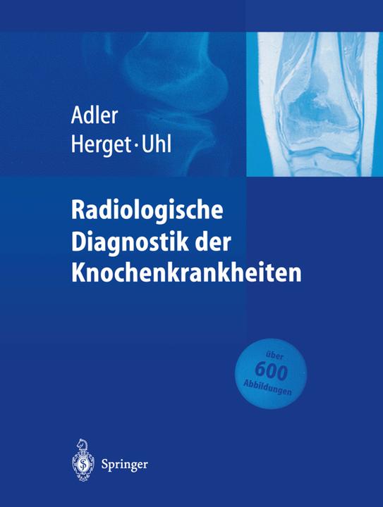 Produktbild Radiologische Diagnostik der Knochenkrankheiten (Deutsch, Claus-Peter Adler, Georg Herget, Markus Uhl, 2014)