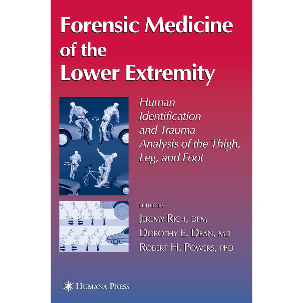 Forensic Medicine of the Lower Extremity, Fachbücher von Dorothy E. Dean, Robert H. Powers, Jeremy Rich