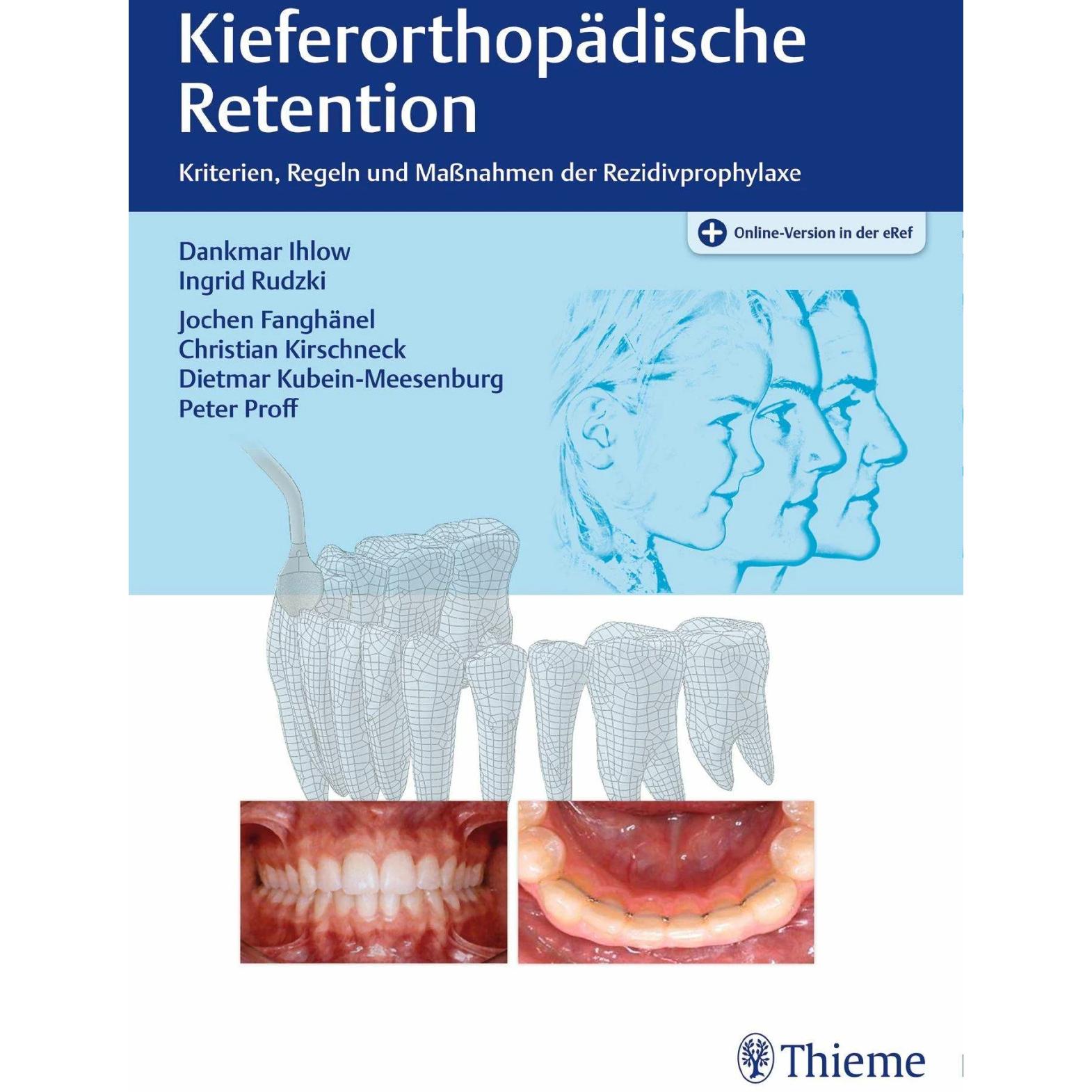Thumbnail - Kieferorthopädische Retention, Fachbücher von Dankmar Ihlow, Ingrid Rudzki