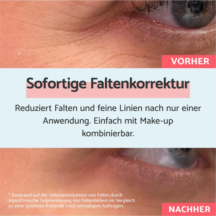 Produktbild Remescar Sofortige Faltenkorrektur (Augenpflege Crème, 8 ml, Tag)