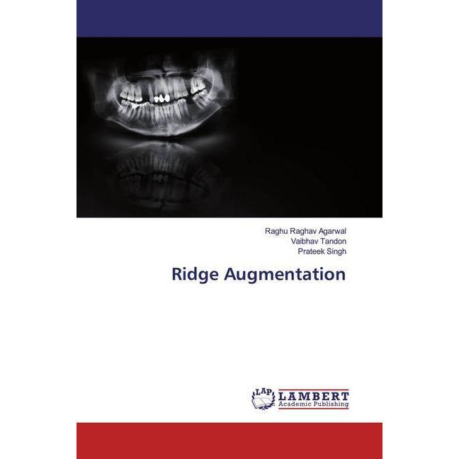 Ridge Augmentation, Fachbücher von Raghu Raghav Agarwal Vaibhav Tandon Prateek Singh