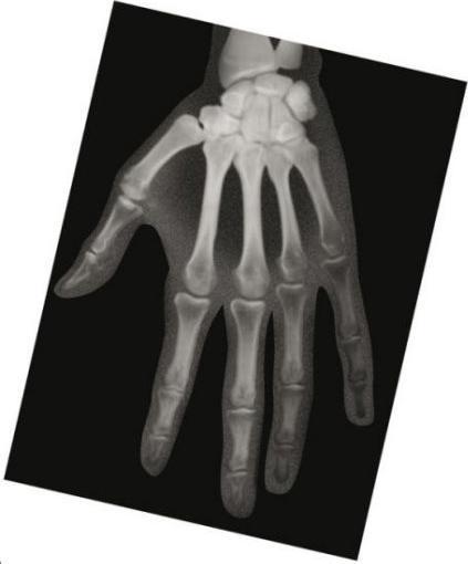 Produktbild Roylco Röntgenbilder Mensch