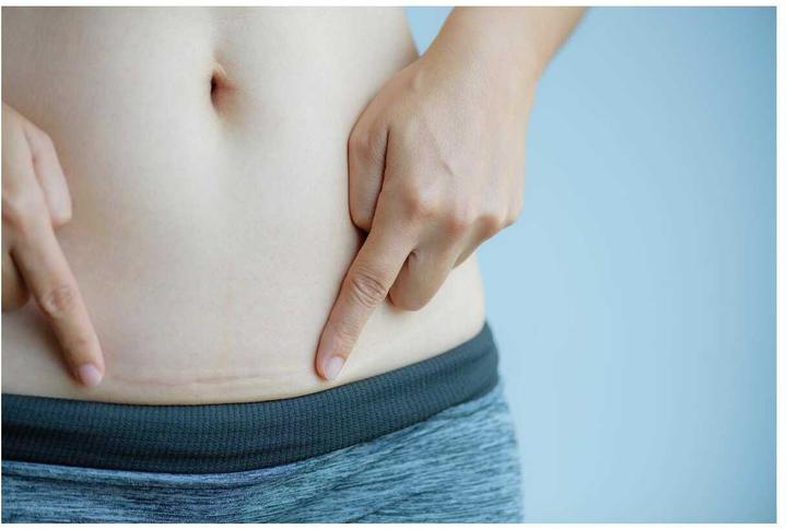 Actual product image Hansaplast Narben Reduktion (21 x)