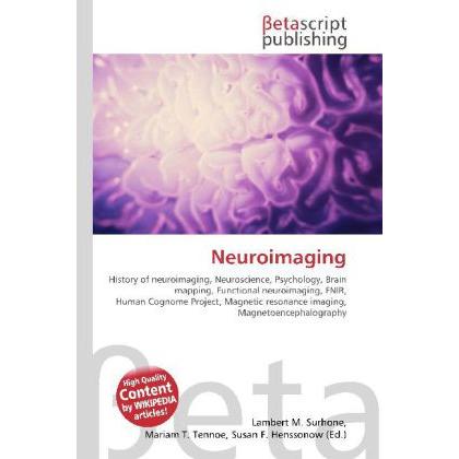 Neuroimaging, Fachbücher von Susan F. Marseken, Miriam T. Timpledon, Lambert M. Surhone