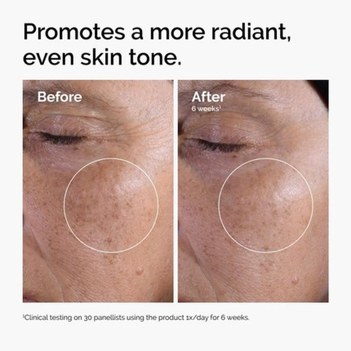 Actual product image The Ordinary Glycoid Acid (Cleansing Foam, 240 ml)