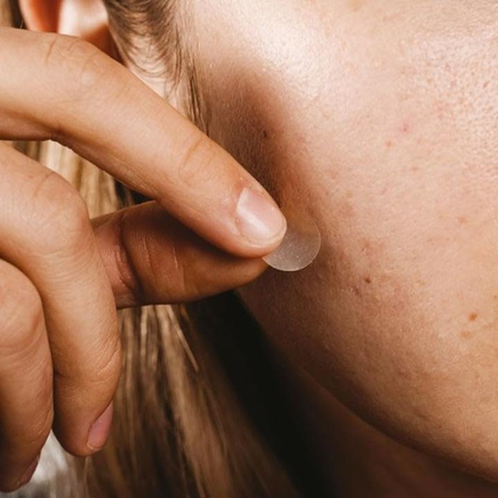 Actual product image Les Pépites Beauté Anti-Pimple Patches