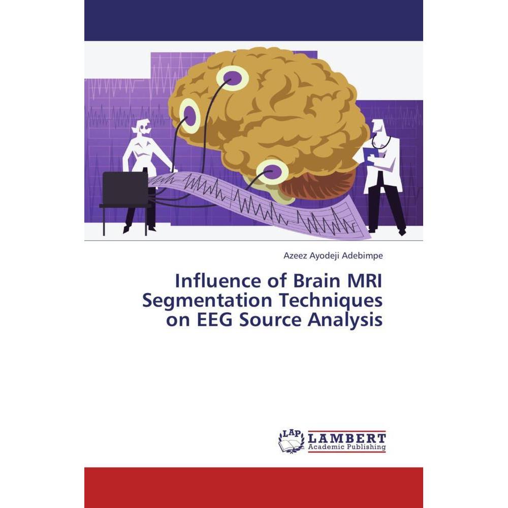 Influence of Brain MRI Segmentation Techniques on EEG Source Analysis, Fachbücher