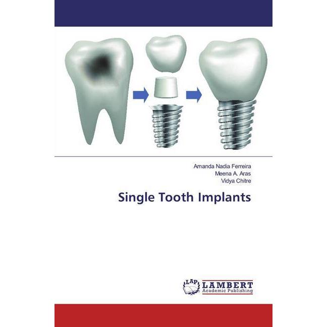 Single Tooth Implants, Fachbücher von Meena A. Aras, Amanda Nadia Ferreira, Vidya Chitre